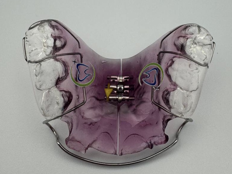 image-02-10-24-11-03-2.jpeg image-02-10-24-11-03-2.jpeg