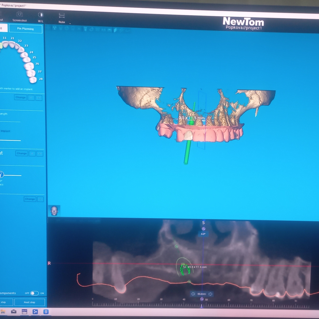 20220518_223259 (1).jpg