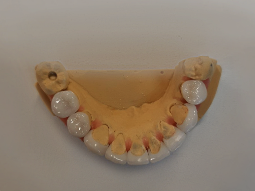 image-04-03-24-10-16.png image-04-03-24-10-16.png