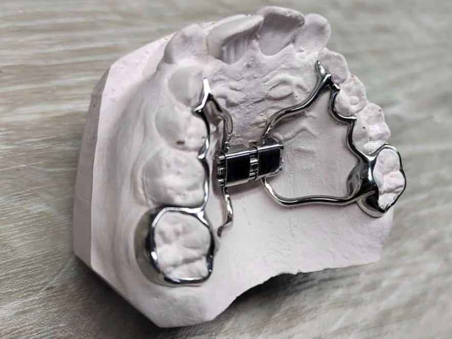 image-02-02-24-11-45.jpeg image-02-02-24-11-45.jpeg